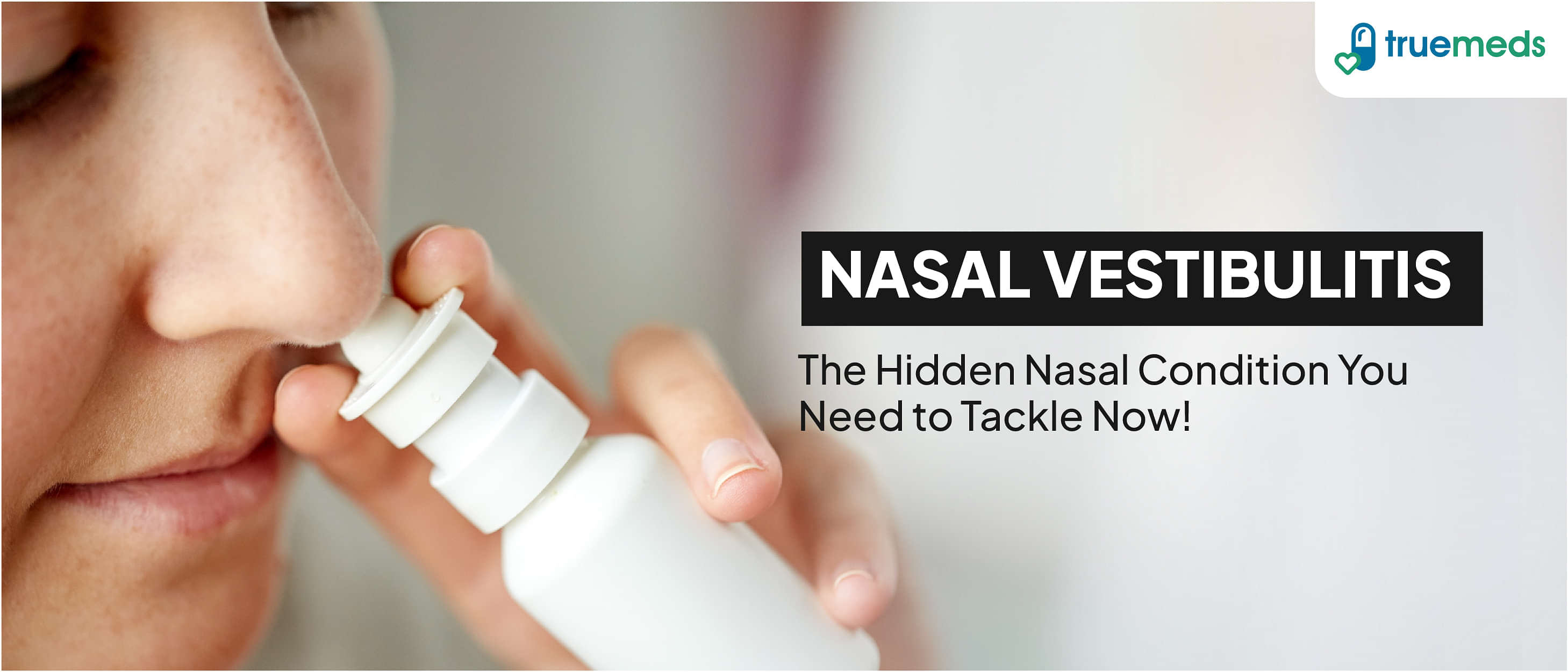 Nasal Vestibulitis: Everything You Need to Know