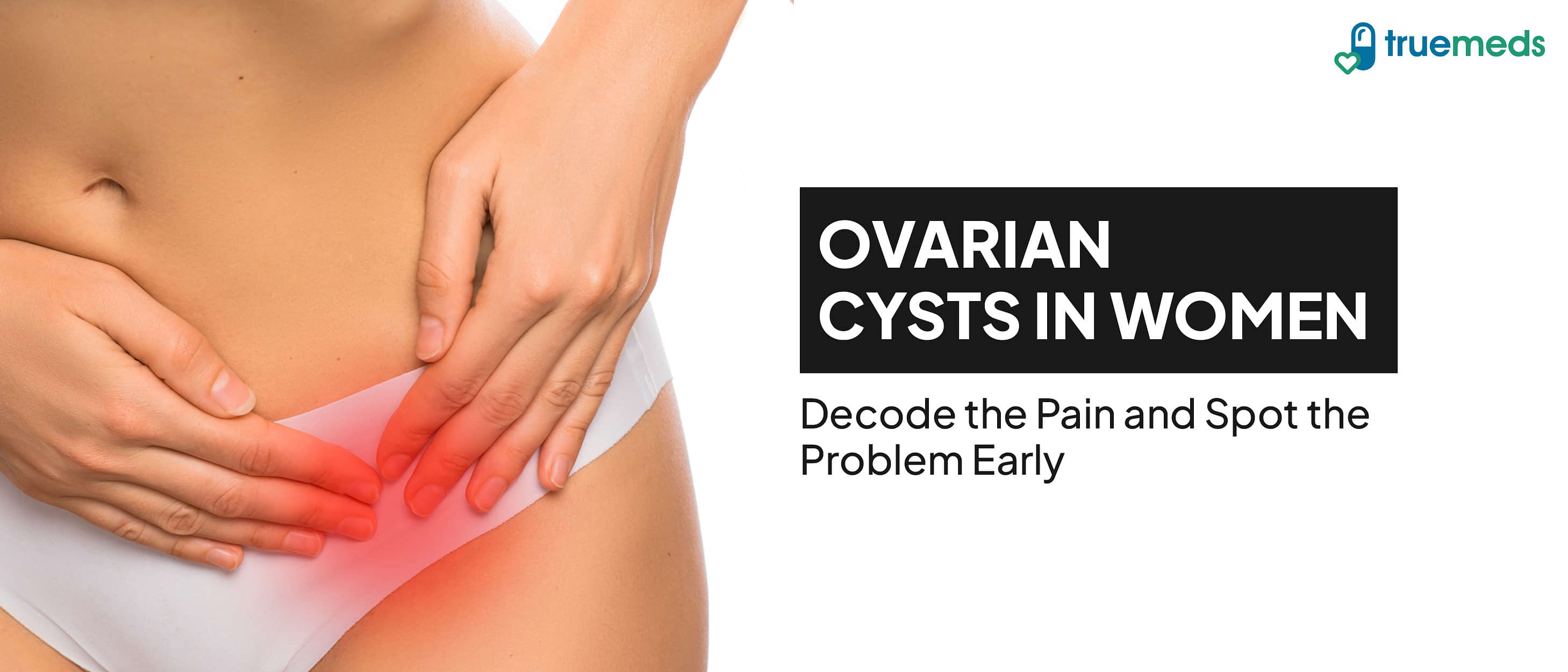 Ovarian Cysts: Symptoms, Causes, and When to Seek Help