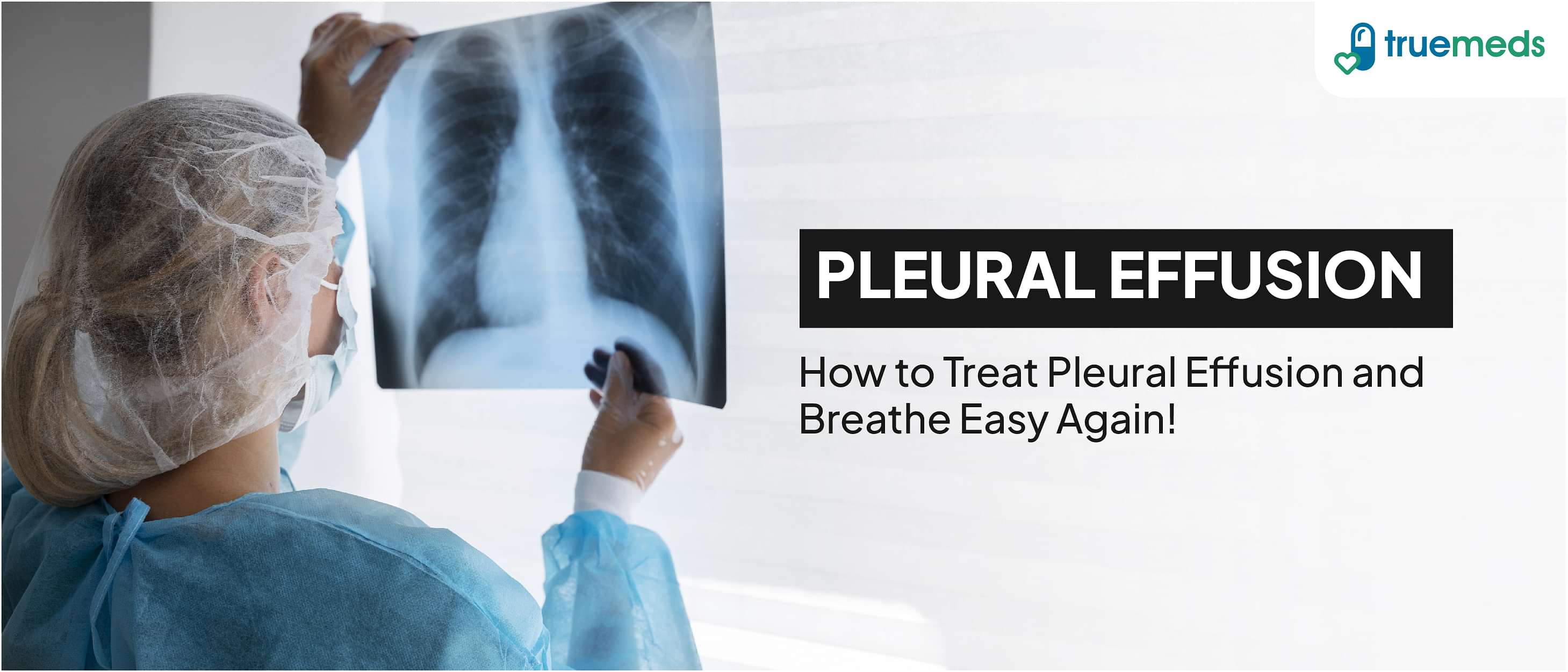 Pleural Effusion: Symptoms, Causes, Treatment &amp; Medication