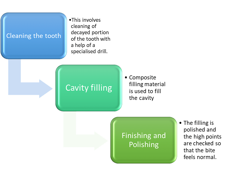 process-of-tooth-cleanings-and-fillings