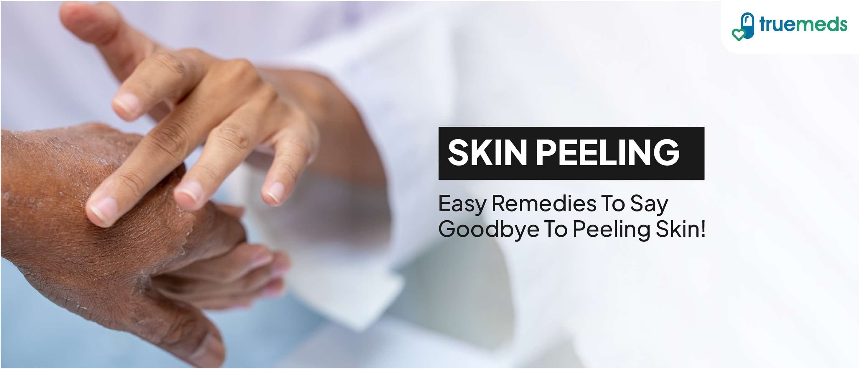 Skin Peeling on Hands: Causes and Quick Relief Tips