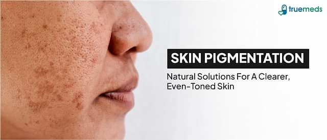 Skin Pigmentation: Overview, and Natural Home Remedies