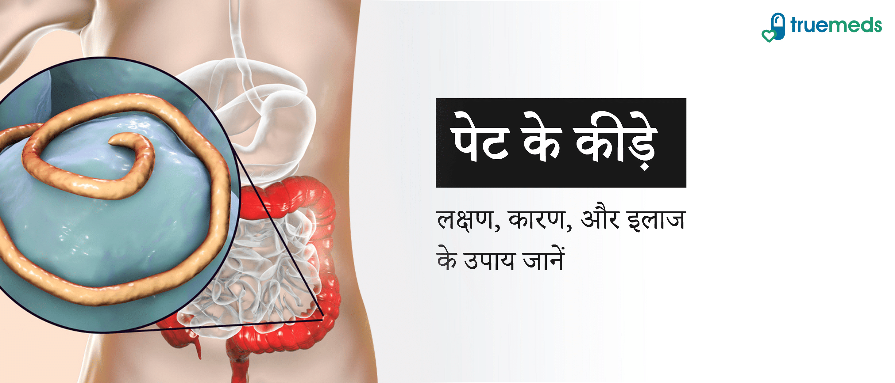 पेट के कीड़े क्यों होते हैं? लक्षण, कारण और इलाज जानें