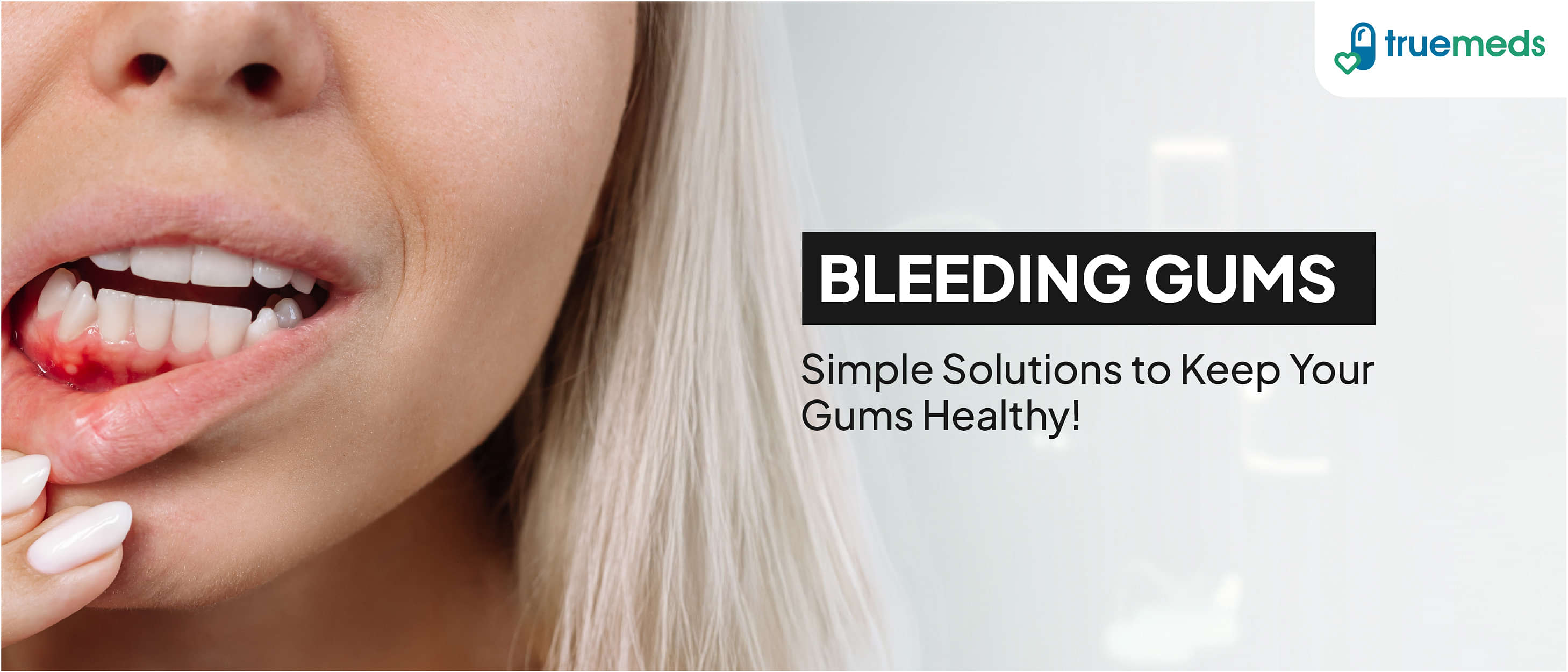 Top 10 Effective Home Remedies for Bleeding Gums