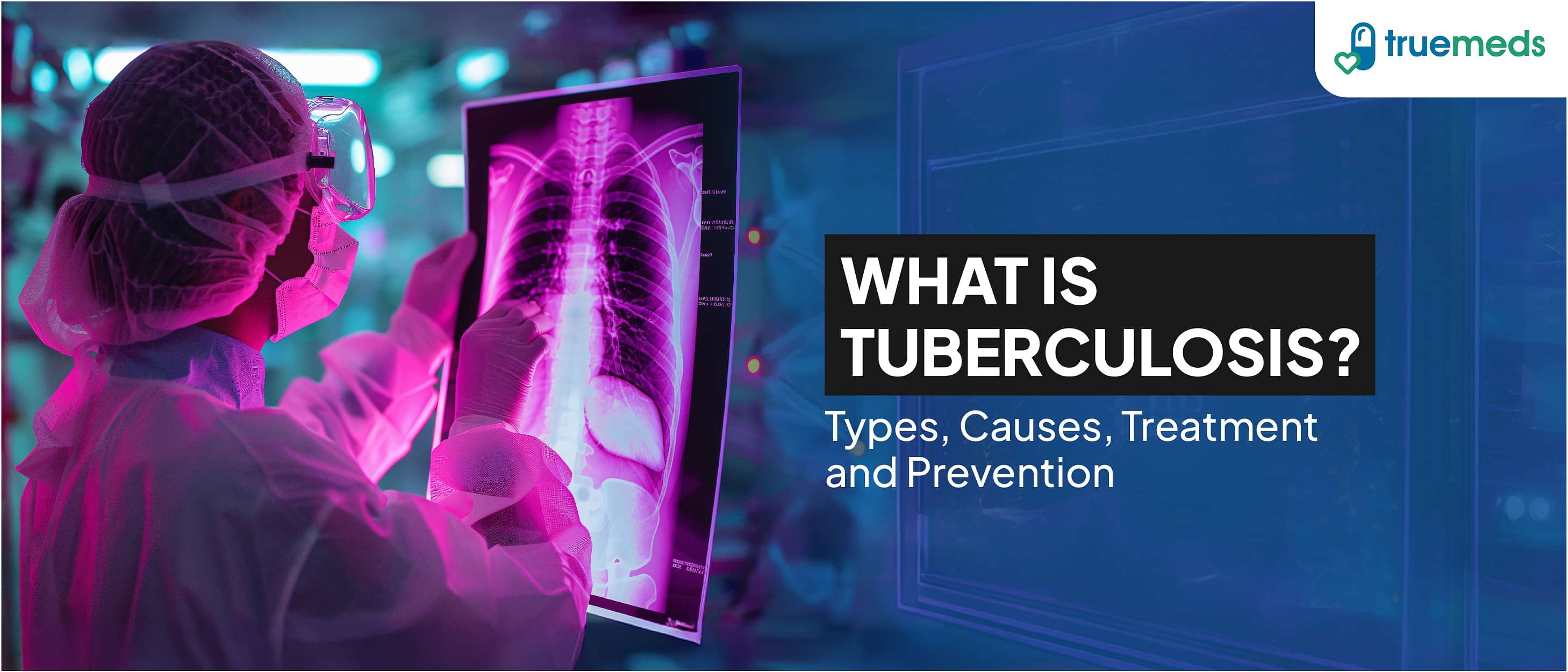 What is Tuberculosis: Types, Causes, Treatment And Prevention