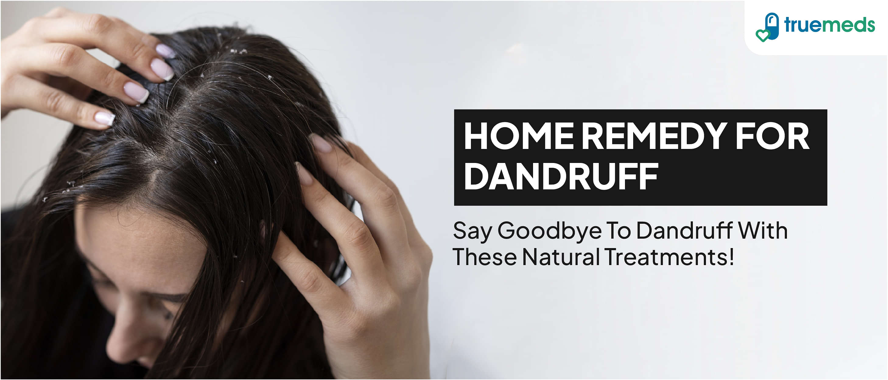 20 Effective Home Remedies to Get Rid of Dandruff Naturally