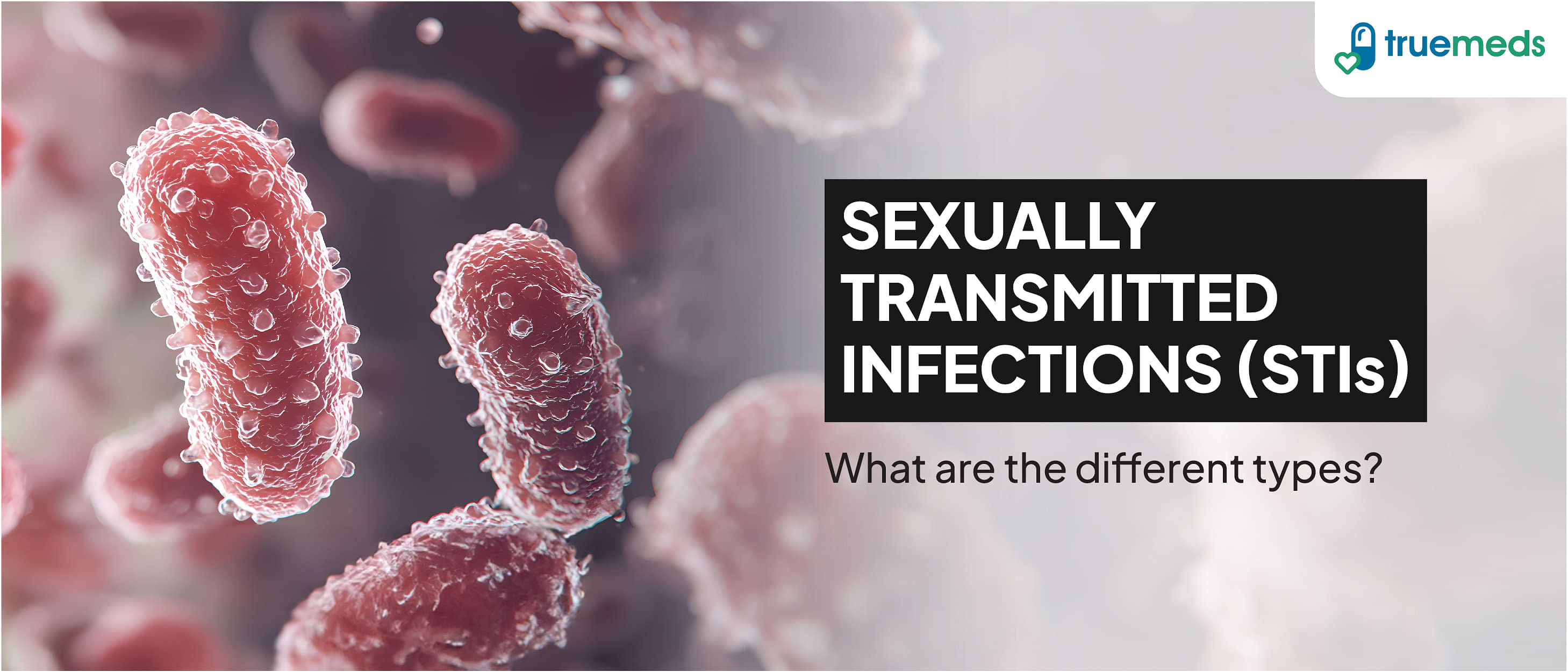 Types of Sexually Transmitted Infections (STIs)