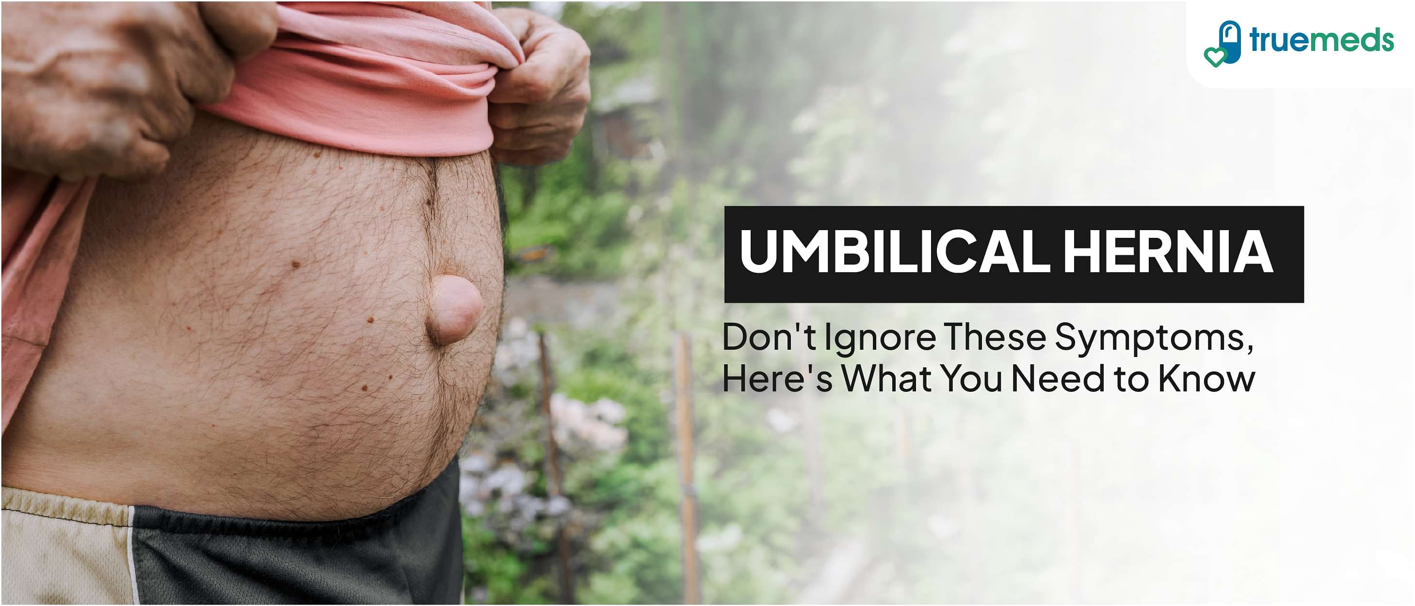 Umbilical Hernia: Causes, Symptoms, Diagnosis, and Treatment