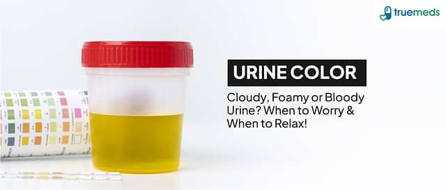 Urine Color Chart: A Guide to Pregnancy, Infections, and Test Results
