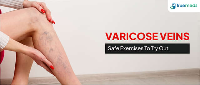 Varicose Veins – 6 Safe Exercises To Try Out