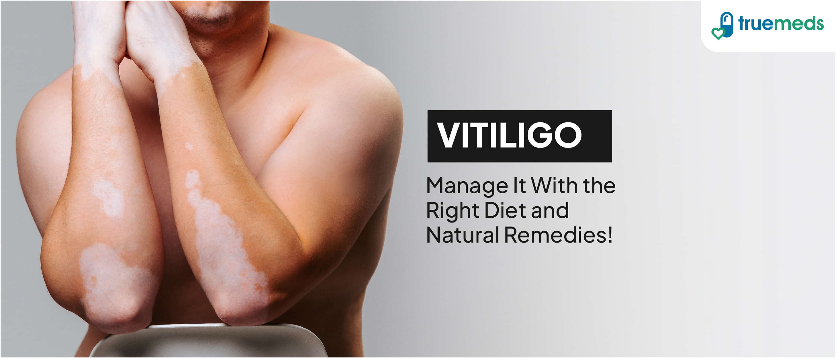 Vitiligo Overview: Diet and Natural Remedies for Vitiligo Cure