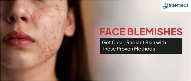 What Are Blemishes on the Face: Effective Removal Tips