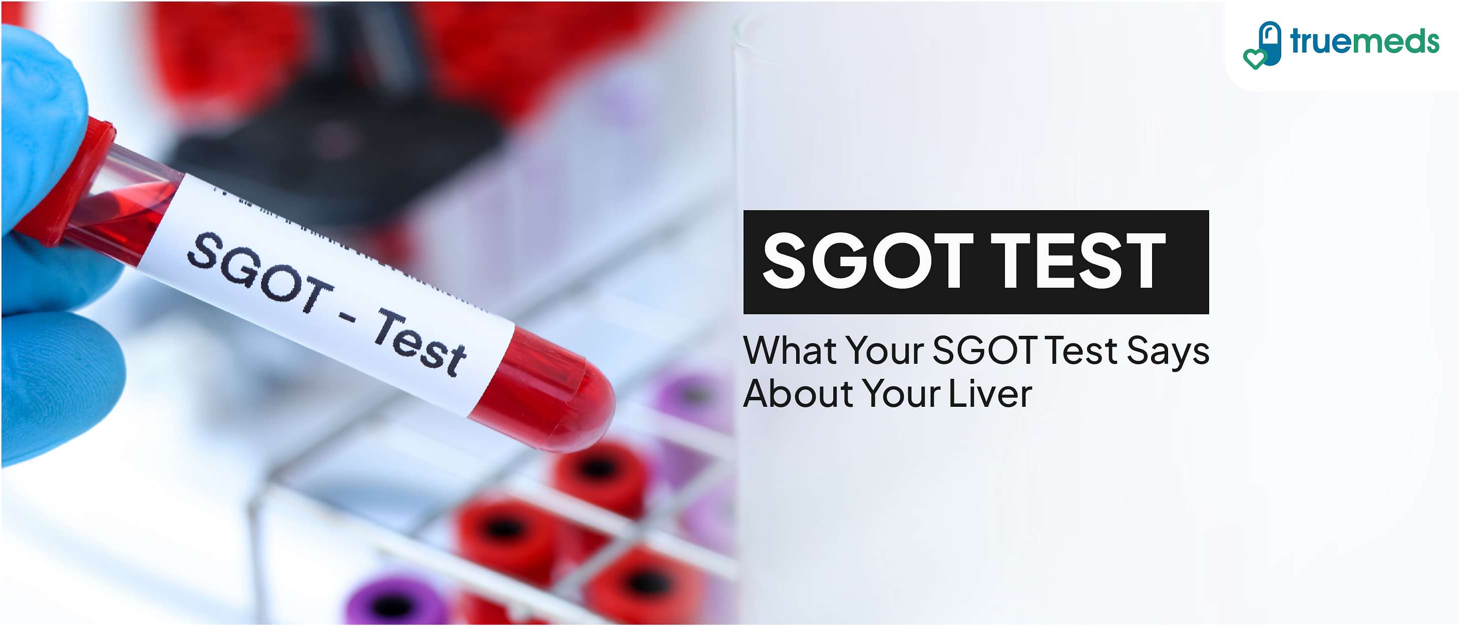 What is SGOT Test? Uses, Normal Range, and How to Interpret Results