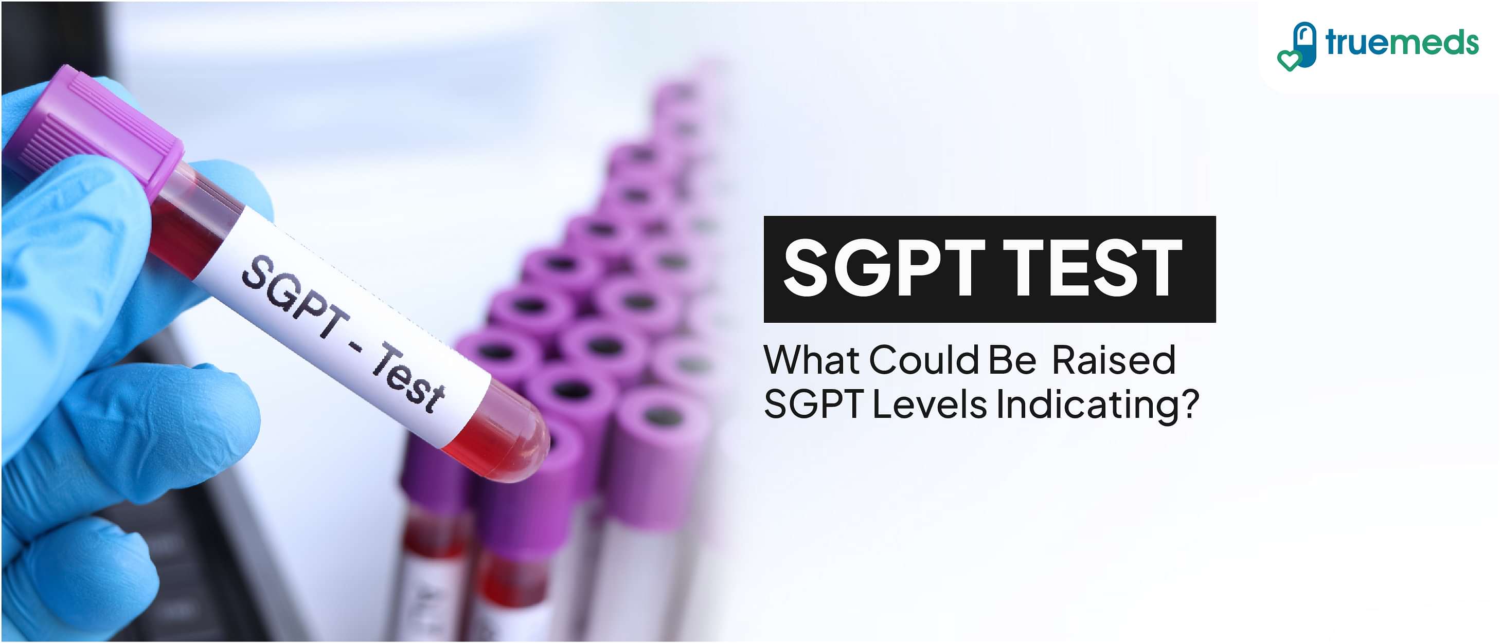 What is SGPT Test? Uses, Normal Range, and How to Interpret Results