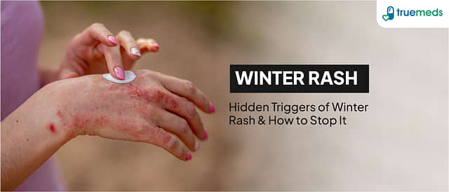 Winter Rash: Causes, Symptoms, and Home Remedies